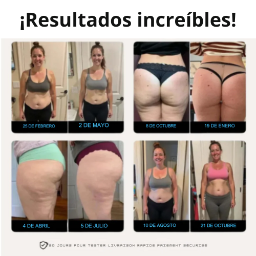 Leggings 3D que moldean y reducen celulitis