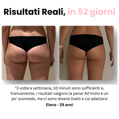 Velora™ - Masajeador anticelulítico